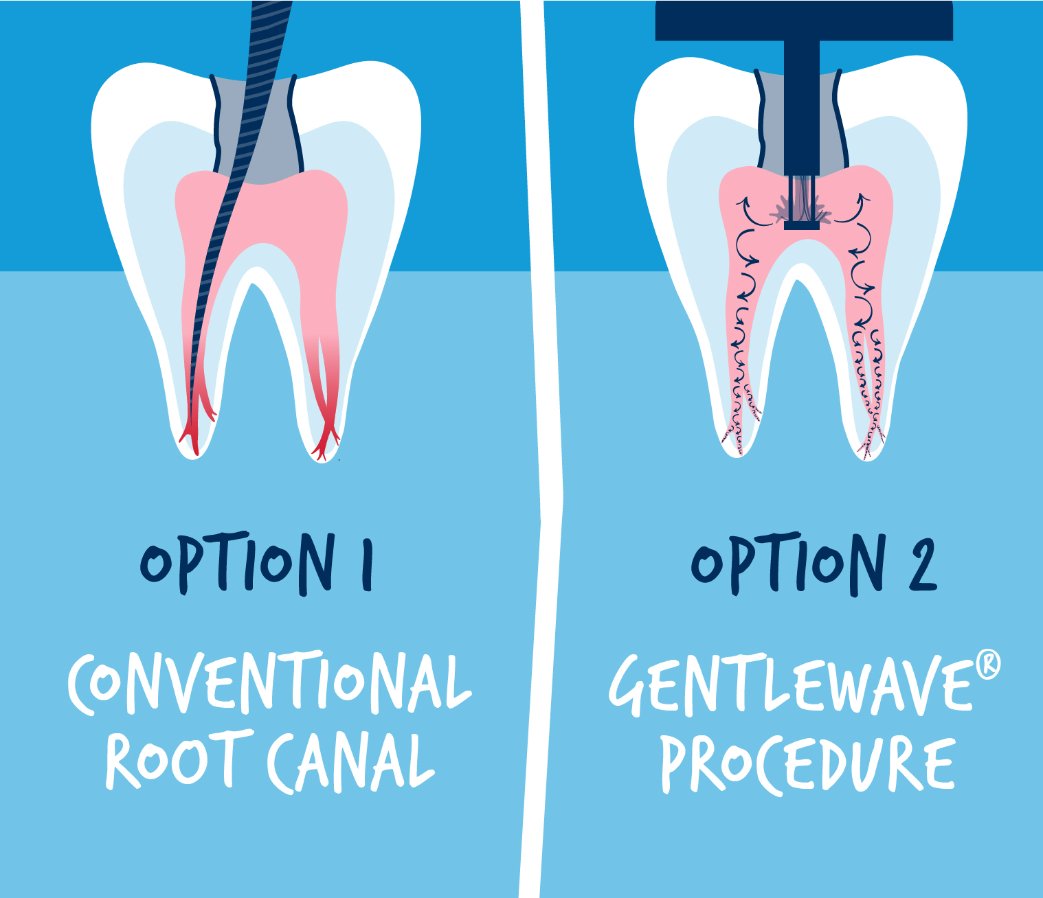 travel insurance root canal